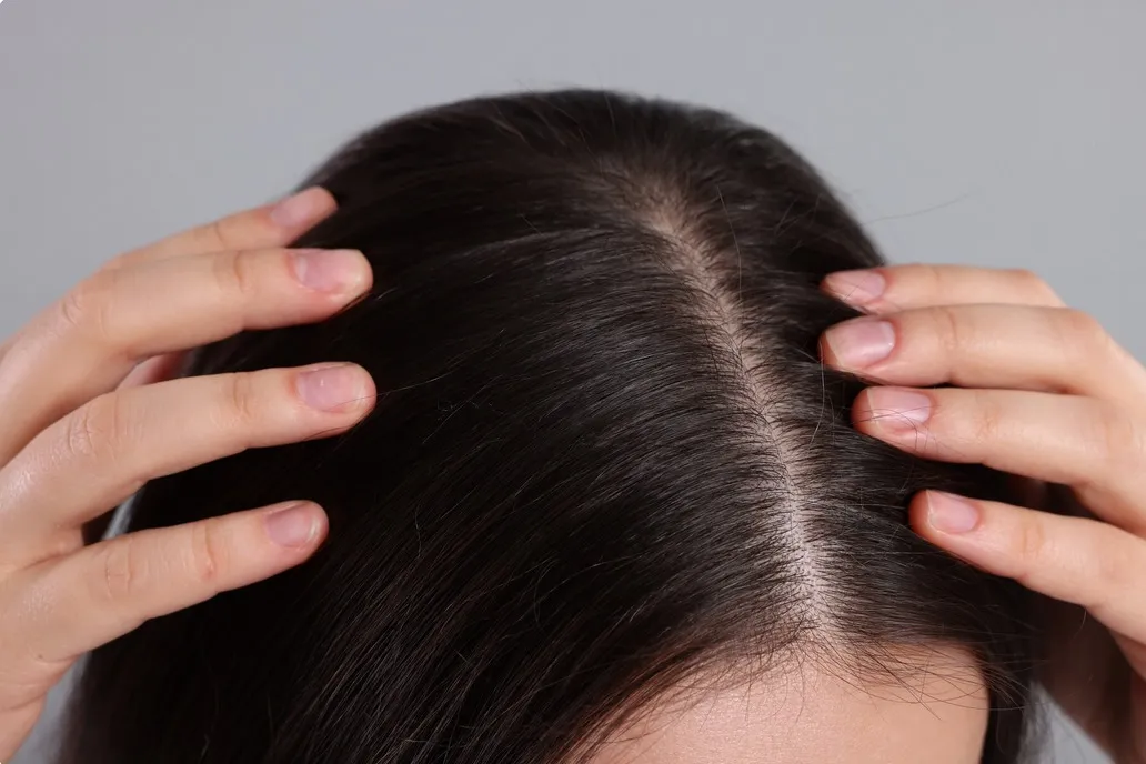 Perché i capelli diventano grassi e come prevenirlo? Consulenza di esperti
